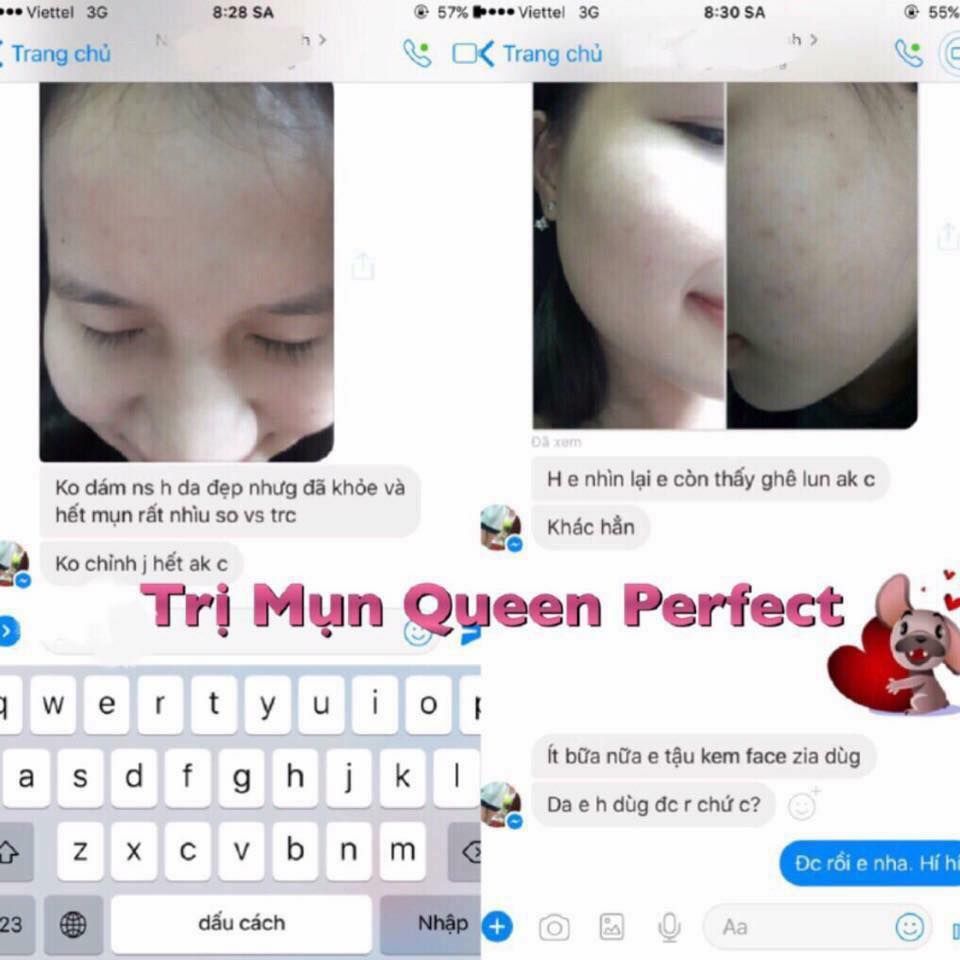 Kem đặc trị Mụn Queen Perfect hiệu quả sau 3-5 ngày